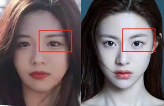 韩国新一代整形模板是史诗级诈骗吧?哇,互联网的美_圈子-新氧美容整形