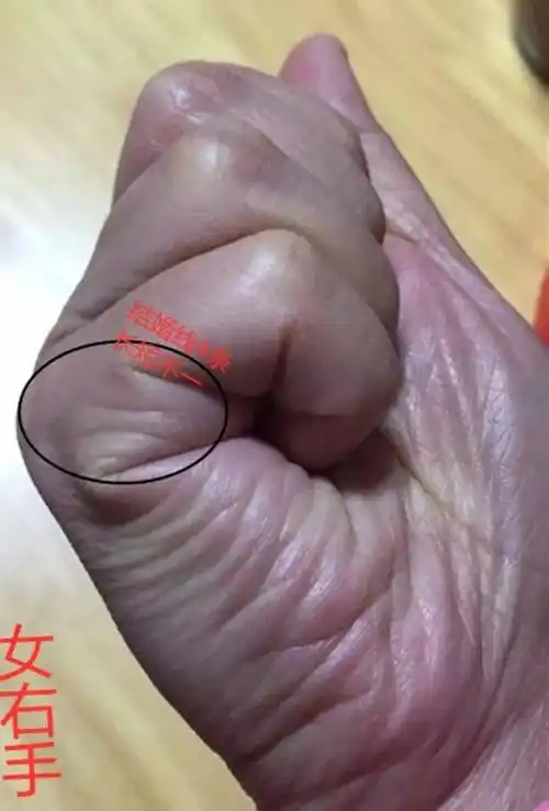 手相:手有三角,富到九十九!