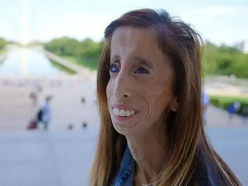 "世界最丑女人"因演讲走红 获30万粉丝