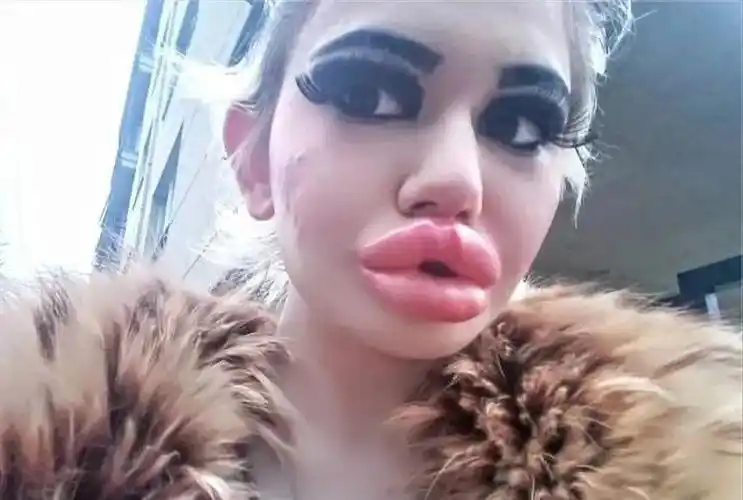 丑女之战|香橙|外貌_新浪新闻