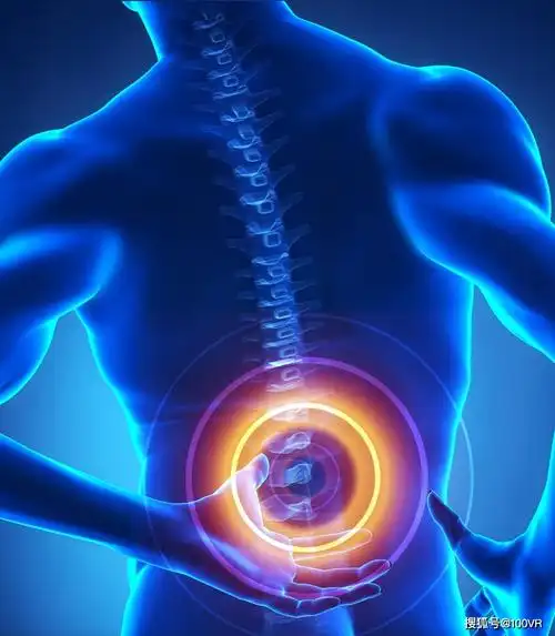 腰疼千万不能忍!4招自测腰椎间盘突出