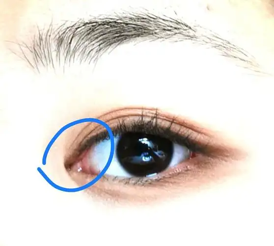 uu们眼角怎么开啊