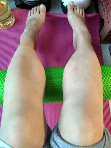 小腿天生腓肠肌粗壮的妹子怎么拯救?