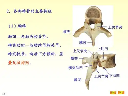 横突肋凹 棘突 上关节突 下肋凹