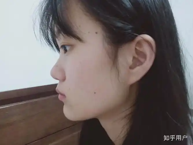 侧脸很平啊怎么办啊感觉脸就是一条线下去了特别丑眼睛近视还突嘴也突