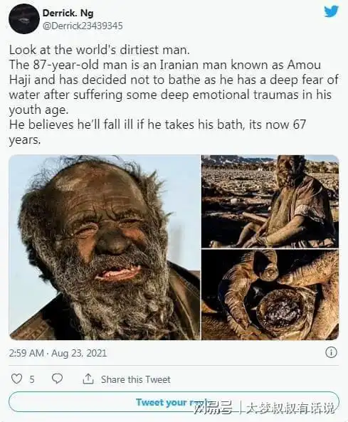 67年没洗过澡!他破吉尼斯纪录成「全世界最脏的人」原因逼哭网友|阿穆