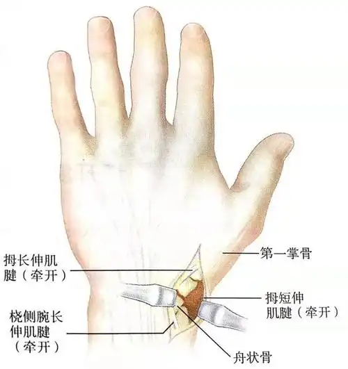 舟状骨骨折固定方案详解看完的人都收藏了