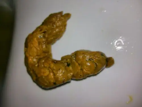 这样大便正常吗