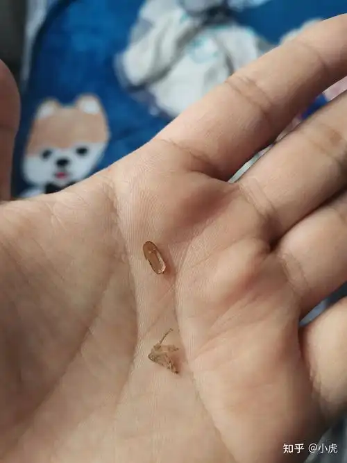 知乎大神求救这是蟑螂卵鞘吗