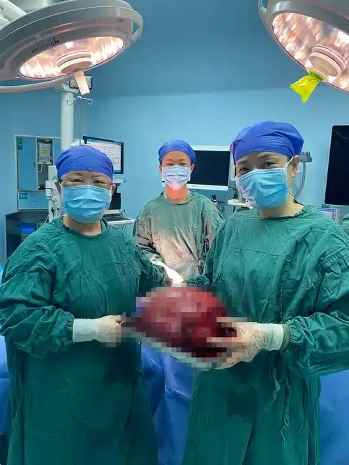 50岁长沙女子肚子大如怀孕,术中取出足球大小子宫肿瘤_蔡女士_肌瘤