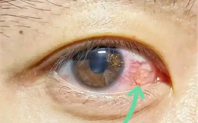 肝好不好,看眼睛就知道了.