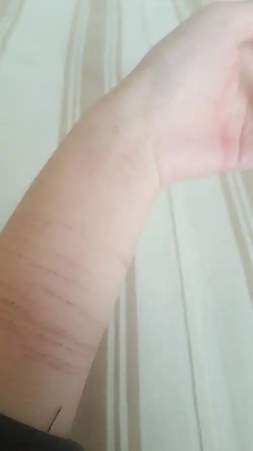 嘿嘿嘿,记录,第二次的自残,6刀,感觉还不错,心情很愉悦