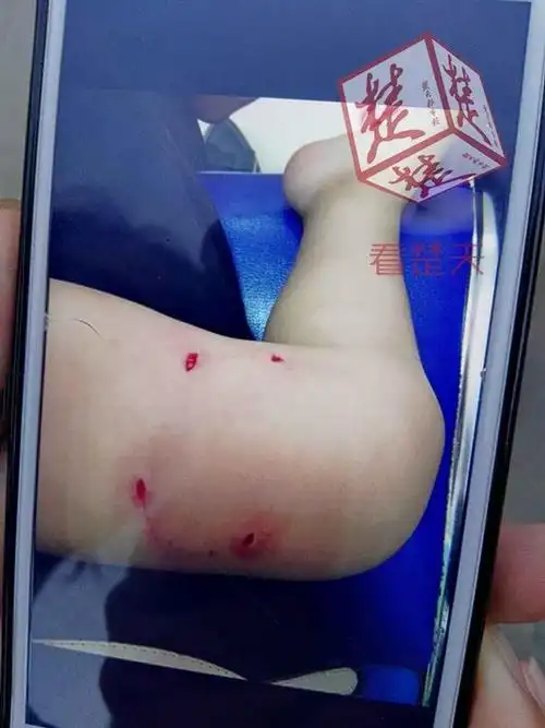 野狗小区内外连咬6人场面血腥