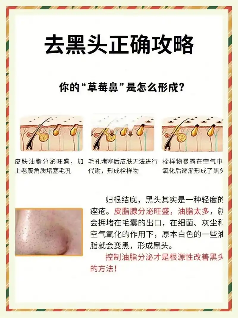 去黑头.现在网上各种去黑头的方法,技巧,我们也尝试了很多,到 - 抖音