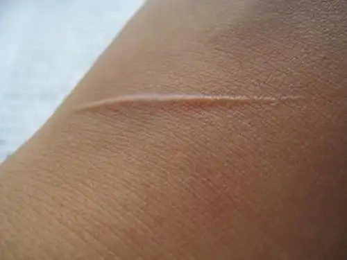 手上有一个刀疤,不久前开始抹滴入了薰衣草精油的海棠油.