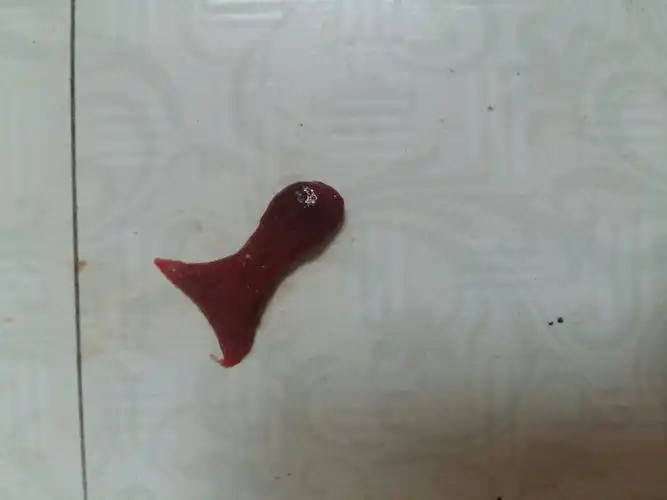 这俩天大姨妈来了,刚刚上厕所的时候发现卫生巾上面粘了一个血红血红