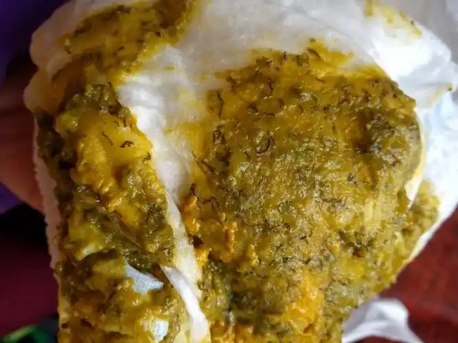 图片有点恶心,但是我很担心,今天早上宝宝的便便怎么是这样子的,里面