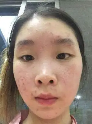 皮肤暗沉发黄,竟然可以通过这些改善