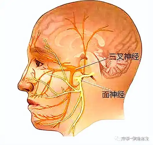 风险较低在侧耳后打开一个2cm的孔,然后利用高倍显微镜将面神经与责任