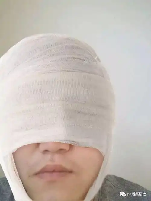 大神回复:6,求大神帮我p点纱布绑在头上,像头部受伤大神回复:5,求大神