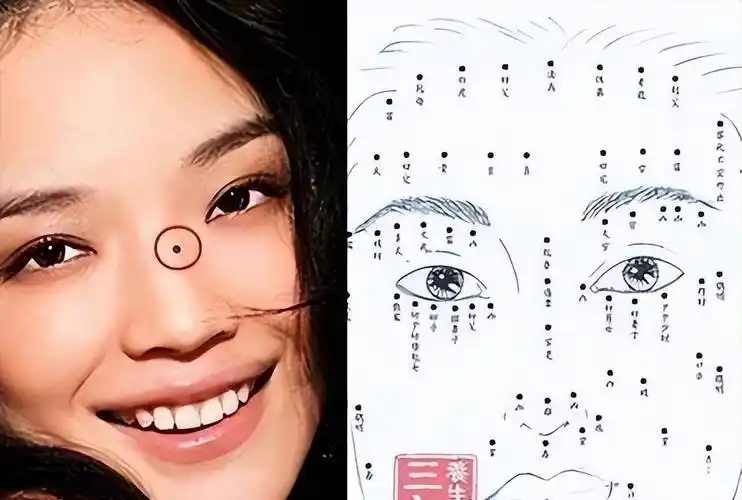 女人脸上这三个部位有痣,没必要去掉!