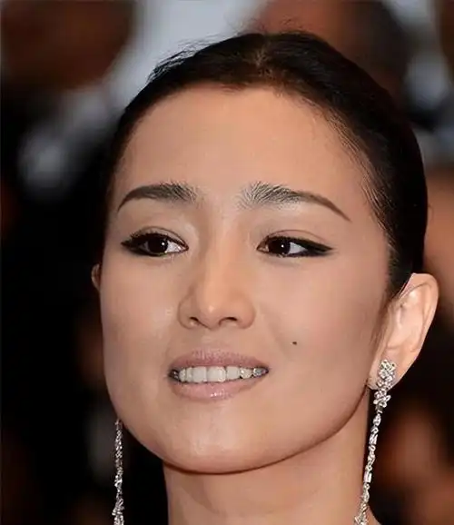 脸上的痣不能随便去掉这几位明星的痣拔高了真实颜值