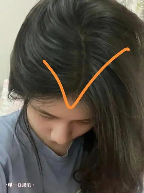 刷到这条说明你的头顶正在长头发