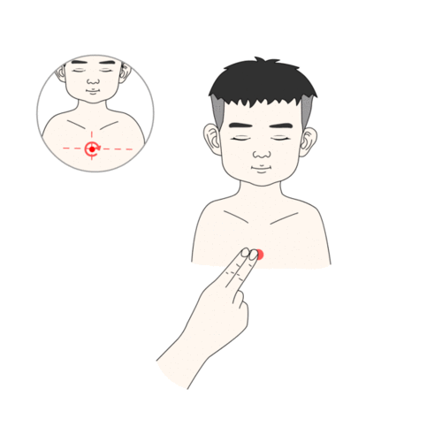 【平肝清肺,点天突,膻中,点揉肺俞】左升右降,恢复肺的肃降功能,止咳