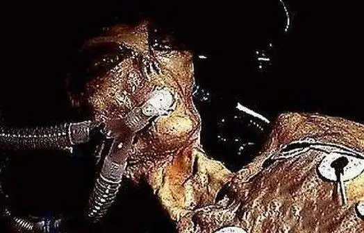 ufo外星人尸体多图