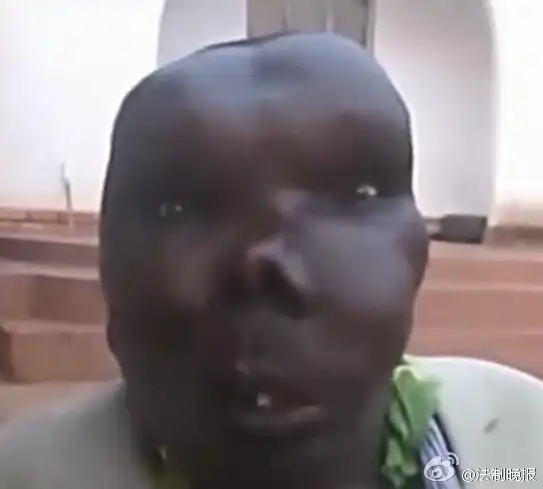 乌干达"最丑男子"靠脸吃饭