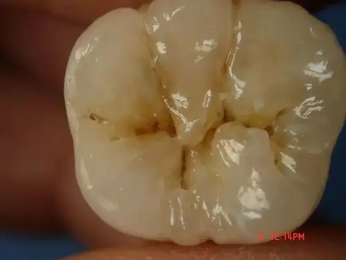 口腔清洁会用牙线还不够有完没完啊