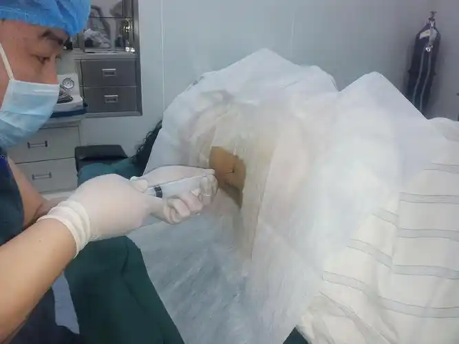 腰椎旁神经阻滞术