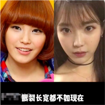 up主表示iu先祛除唇毛让自己看起来更干净一些,再配合减肥和瘦脸针,她