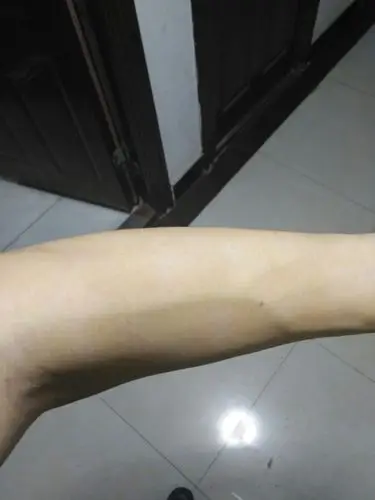 怎么回事啊?是什么原因造成的应该怎么改善,请看图