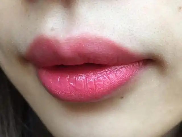 激光脱唇毛一般只需7~10天就可恢复,而且能起到持续的效果