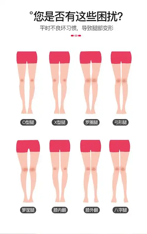 鸿竹(hongzhu)护具(器械) o型腿矫正腿型神器直腿绑腿束腿带xo矫正