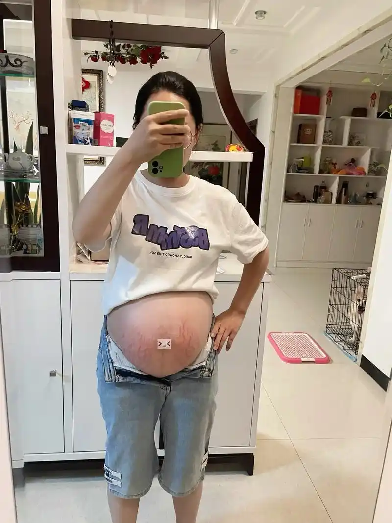 什么是勇敢不要回头看 看到一句关于妊娠纹的话很美 you