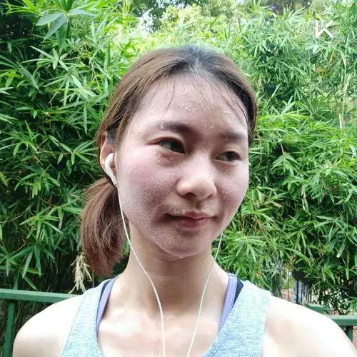 一起去公园跑步张歆艺晒跑步健身照脸颊绯红香汗淋漓夏天运动出汗好多