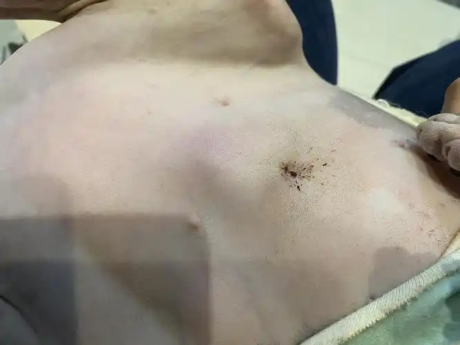 讨论母猫绝育完伤口会鼓吗