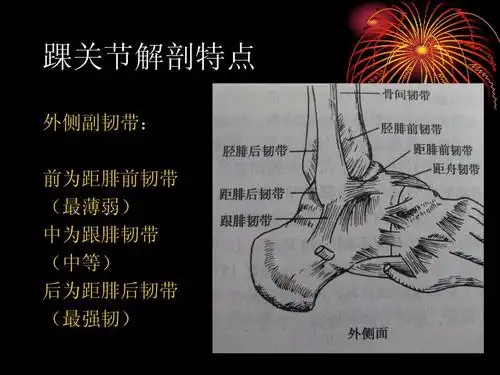 踝关节解剖特点 外侧副韧带: 前为距腓前韧带 (最薄弱) 中为跟腓韧带