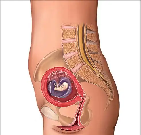 几乎占据了身长的大部分;正常的宫内孕,胎盘附着于子宫体的底部,后壁