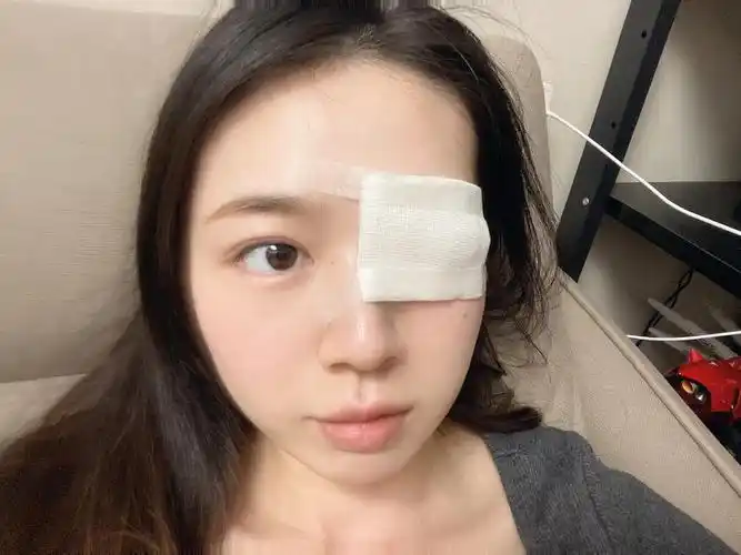 长了半年的麦粒肿终于割掉了