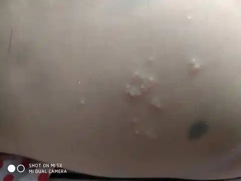 我家宝宝屁股上长好多小疙瘩,这是什麼啊?