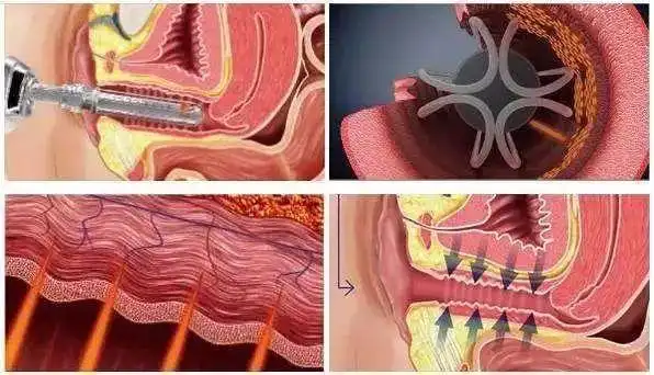 女性私密悄悄话听完让我泪落下