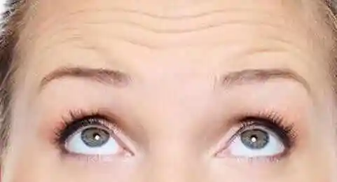 抬头纹法令纹鱼尾纹颈纹(鱼尾纹法令纹顺口溜)