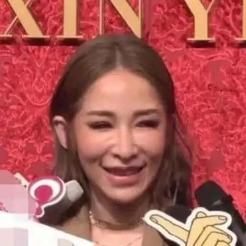 75萧亚轩整容失败75