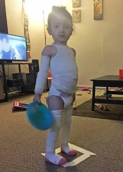 3岁女孩真实的"木乃伊"生活 | 故事