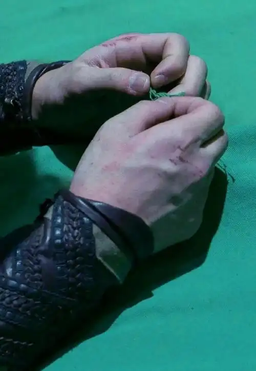 琅琊榜飞流扮演者小飞流吴磊伤痕累累的影视之路