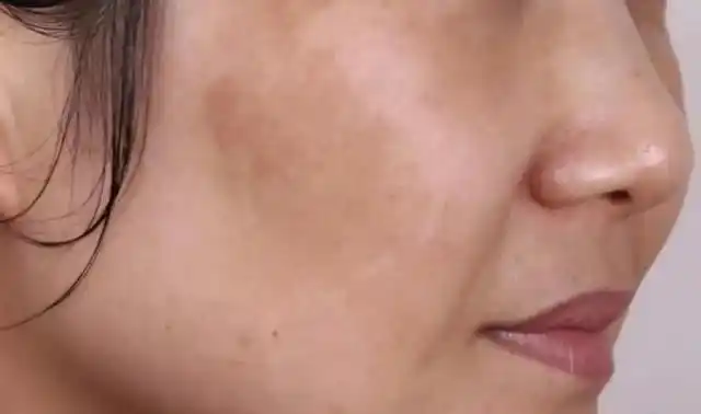 谁都想拥有像剥了壳的鸡蛋那样,光滑细腻的皮肤.