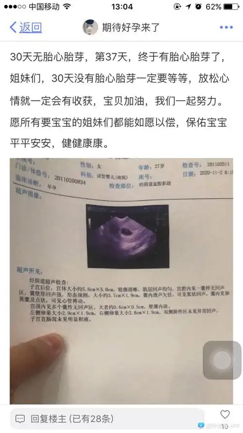 [试管婴儿]囊胚移植30天一超,孕囊2.